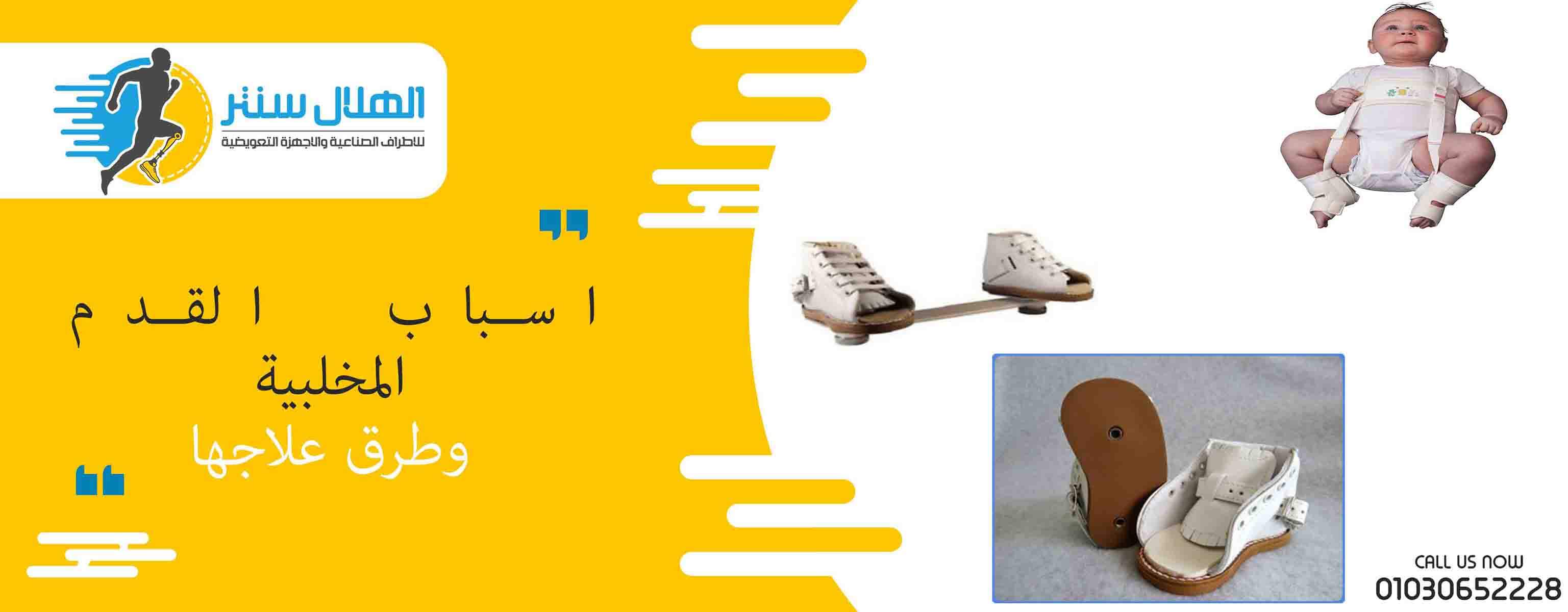 مقالات Page 2 of 13 الهلال سنتر للاطراف الصناعية والاجهزة التعويضية