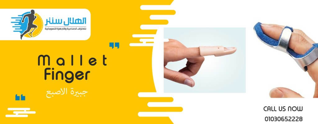 انواع الجبائر الطبية وطرق استخدامها الهلال سنتر للاطراف الصناعية