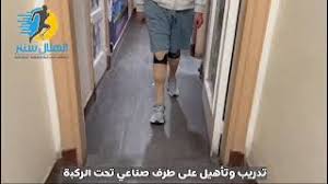 جلسة تأهيل بعد تركيب طرف صناعي – خدمات الهلال سنتر 